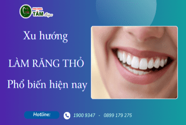 XU HƯỚNG LÀM RĂNG THỎ PHỔ BIẾN HIỆN NAY 