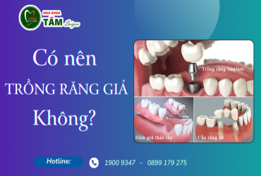 CÓ NÊN TRỒNG RĂNG GIẢ KHÔNG?