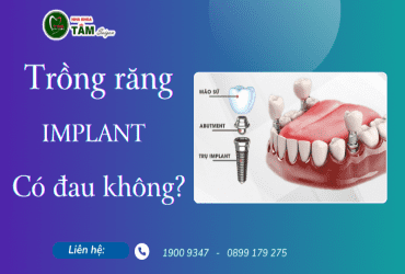 TRỒNG RĂNG IMPLANT CÓ ĐAU KHÔNG?