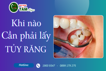 KHI NÀO CẦN PHẢI LẤY TỦY RĂNG 