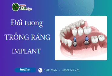 ĐỐI TƯỢNG NÀO TRỒNG RĂNG IMPLANT 