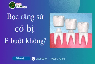 BỌC RĂNG SỨ CÓ BỊ Ê BUỐT KHÔNG? 