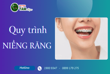 QUY TRÌNH NIỀNG RĂNG 