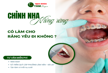 NIỀNG RĂNG CÓ LÀM CHO RĂNG YẾU ĐI?