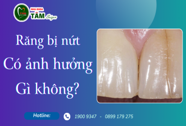 RĂNG BỊ NỨT CÓ ẢNH HƯỞNG GÌ KHÔNG?