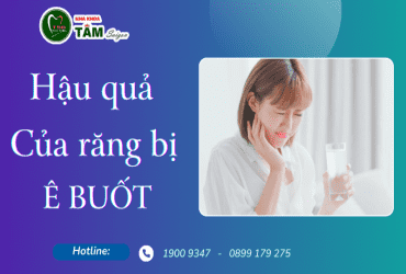 HẬU QUẢ CỦA RĂNG BỊ Ê BUỐT 