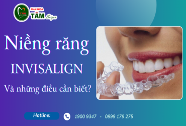 NIỀNG RĂNG INVISALIGN VÀ NHỮNG ĐIỀU BẠN NÊN BIẾT