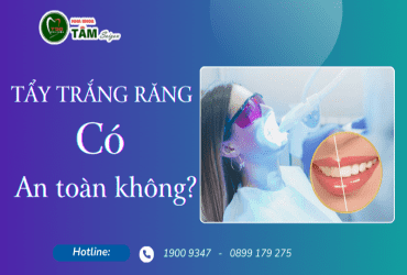 TẨY TRẮNG RĂNG CÓ AN TOÀN KHÔNG?