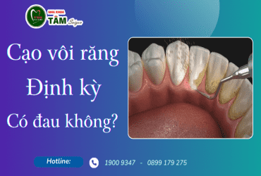 CẠO VÔI RĂNG ĐỊNH KỲ CÓ ĐAU KHÔNG?