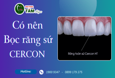 CÓ NÊN BỌC RĂNG SỨ CERCON KHÔNG?