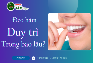 PHẢI ĐEO HÀM DUY TRÌ TRONG BAO LÂU?