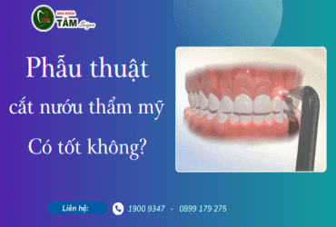 PHẨU THUẬT CẮT NƯỚU THẨM MỸ CÓ TỐT KHÔNG?