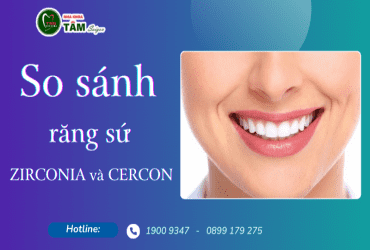 SO SÁNH RĂNG SỨ ZIRCONIA VÀ CERCON 