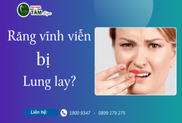 RĂNG VĨNH VIỄN BỊ LUNG LAY ?