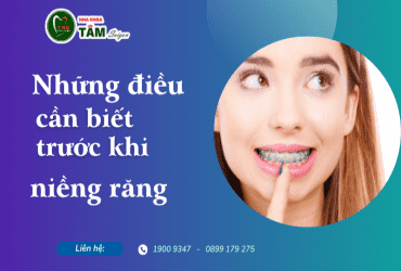 NHỮNG ĐIỀU BẠN CẦN BIẾT TRƯỚC KHI NIỀNG RĂNG!