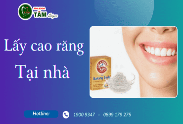 LẤY CAO RĂNG TẠI NHÀ 