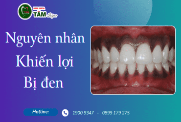 NGUYÊN NHÂN KHIẾN LỢI BỊ ĐEN 