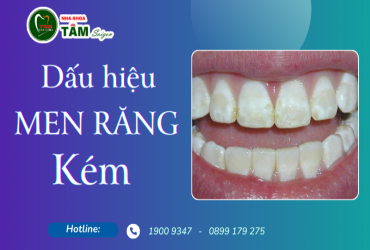 NHỮNG DẤU HIỆU MEN RĂNG KÉM 