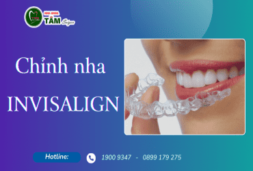 CHỈNH NHA INVISALIGN 