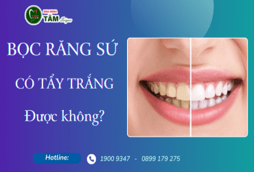 BỌC RĂNG SỨ CÓ TẨY TRẮNG ĐƯỢC KHÔNG?