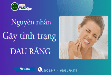 NGUYÊN NHÂN GÂY ĐAU RĂNG 