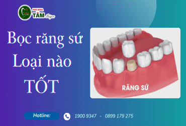 BỌC RĂNG SỨ LOẠI NÀO TỐT?