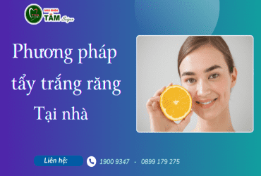 PHƯƠNG PHÁP LÀM TRẮNG RĂNG TẠI NHÀ HIỆU QUẢ?