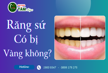 RĂNG SỨ CÓ BỊ VÀNG KHÔNG?