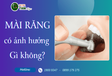 MÀI RĂNG CÓ ẢNH HƯỞNG GÌ KHÔNG?