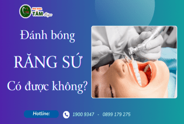 ĐÁNH BÓNG RĂNG SỨ CÓ ĐƯỢC KHÔNG? 