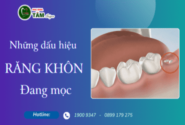 NHỮNG DẤU HIỆU RĂNG KHÔN ĐANG MỌC 