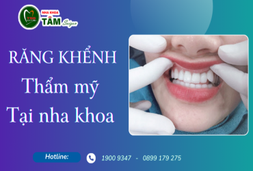 RĂNG KHỂNH THẨM MỸ TẠI NHA KHOA 