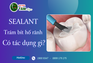 SEALANT TRÁM BÍT HỐ RÃNH CÓ TÁC DỤNG GÌ?