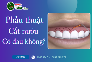 PHẪU THUẬT CẮT NƯỚU CÓ ĐAU KHÔNG?