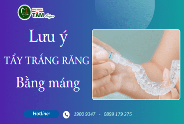 MỘT SỐ LƯU Ý KHI TẨY TRẮNG RĂNG BẰNG MÁNG 