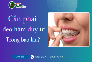 NIỀNG RĂNG CẦN PHẢI ĐEO HÀM DUY TRÌ TRONG BAO LÂU?