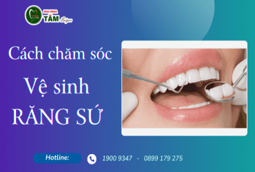 CÁCH CHĂM SÓC VỆ SINH RĂNG SỨ 