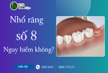 NHỔ RĂNG SỐ 8 CÓ NGUY HIỂM KHÔNG?