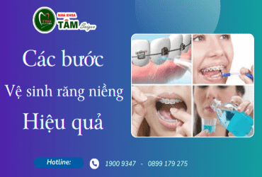 CÁC BƯỚC VỆ SINH RĂNG NIỀNG HIỆU QUẢ 