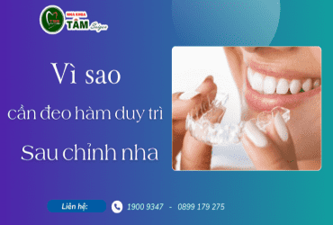 VÌ SAO CẦN ĐEO HÀM DUY TRÌ SAU CHỈNH NHA?