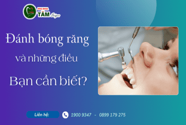 ĐÁNH BÓNG RĂNG VÀ NHỮNG ĐIỀU BẠN CẦN BIẾT