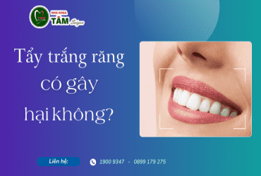 TẨY TRẮNG RĂNG CÓ HẠI KHÔNG?