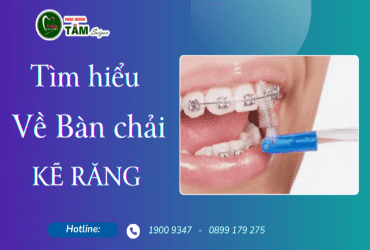 TÌM HIỂU VỀ BÀN CHẢI KẼ RĂNG 