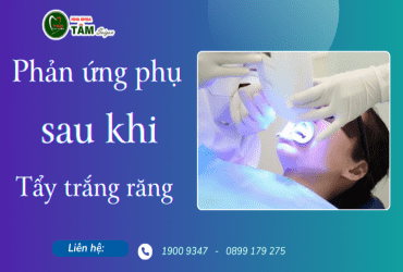 NHỮNG PHẢN ỨNG PHỤ SAU KHI TẨY TRẮNG RĂNG 