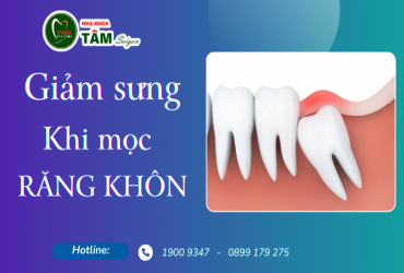 GIẢM SƯNG KHI MỌC RĂNG KHÔN 