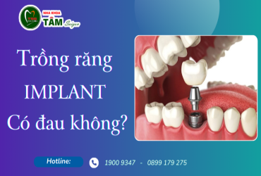 TRỒNG RĂNG IMPLANT CÓ ĐAU KHÔNG?