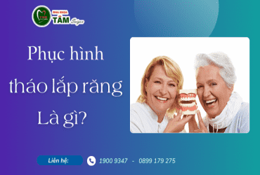 PHỤC HÌNH THÁO LẮP RĂNG LÀ GÌ?