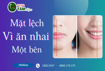 MẶT LỆCH VÌ ĂN NHAI MỘT BÊN 