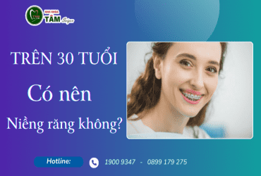 TRÊN 30 TUỔI CÓ NÊN NIỀNG RĂNG KHÔNG?