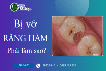 BỊ VỠ RĂNG HÀM PHẢI LÀM SAO? 